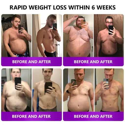 𝑳𝒆𝒓𝒄𝒆𝒂® 𝑺𝑴𝑮𝑻-𝑮𝑳𝑷-1 𝑵𝒂𝒏𝒐 𝑴𝒊𝒄𝒓𝒐𝒏𝒆𝒆𝒅𝒍𝒆 𝑺𝒍𝒊𝒎𝒎𝒊𝒏𝒈 𝑷𝒂𝒕𝒄𝒉