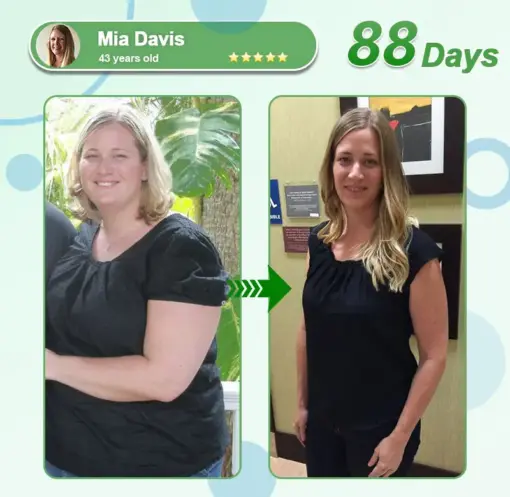 𝑳𝒆𝒓𝒄𝒆𝒂® 𝑵𝒂𝒏𝒐 𝑴𝒊𝒄𝒓𝒐𝒏𝒆𝒆𝒅𝒍𝒆 𝑷𝒂𝒕𝒄𝒉 𝒘𝒊𝒕𝒉 𝑺𝑴𝑮𝑻-𝑮𝑳𝑷-1 & 𝑴𝒂𝒕𝒓𝒊𝒙𝒚𝒍 3000
