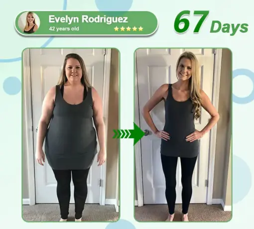 𝑳𝒆𝒓𝒄𝒆𝒂® 𝑵𝒂𝒏𝒐 𝑴𝒊𝒄𝒓𝒐𝒏𝒆𝒆𝒅𝒍𝒆 𝑷𝒂𝒕𝒄𝒉 𝒘𝒊𝒕𝒉 𝑺𝑴𝑮𝑻-𝑮𝑳𝑷-1 & 𝑴𝒂𝒕𝒓𝒊𝒙𝒚𝒍 3000