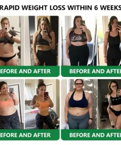 𝑳𝒆𝒓𝒄𝒆𝒂® 𝑵𝒂𝒏𝒐 𝑴𝒊𝒄𝒓𝒐𝒏𝒆𝒆𝒅𝒍𝒆 𝑷𝒂𝒕𝒄𝒉 𝒘𝒊𝒕𝒉 𝑺𝑴𝑮𝑻-𝑮𝑳𝑷-1 & 𝑴𝒂𝒕𝒓𝒊𝒙𝒚𝒍 3000