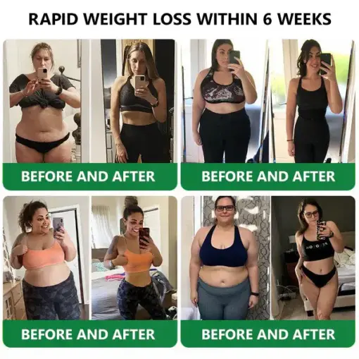 𝑳𝒆𝒓𝒄𝒆𝒂® 𝑵𝒂𝒏𝒐 𝑴𝒊𝒄𝒓𝒐𝒏𝒆𝒆𝒅𝒍𝒆 𝑷𝒂𝒕𝒄𝒉 𝒘𝒊𝒕𝒉 𝑺𝑴𝑮𝑻-𝑮𝑳𝑷-1 & 𝑴𝒂𝒕𝒓𝒊𝒙𝒚𝒍 3000