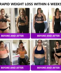 𝑳𝒆𝒓𝒄𝒆𝒂® 𝑺𝑴𝑮𝑻-𝑮𝑳𝑷-1 𝑵𝒂𝒏𝒐 𝑴𝒊𝒄𝒓𝒐𝒏𝒆𝒆𝒅𝒍𝒆 𝑺𝒍𝒊𝒎𝒎𝒊𝒏𝒈 𝑷𝒂𝒕𝒄𝒉