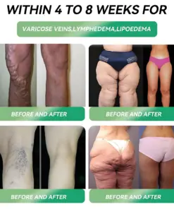 𝑳𝒆𝒓𝒄𝒆𝒂® GLP-1 Oral Weight Loss Solution Indications