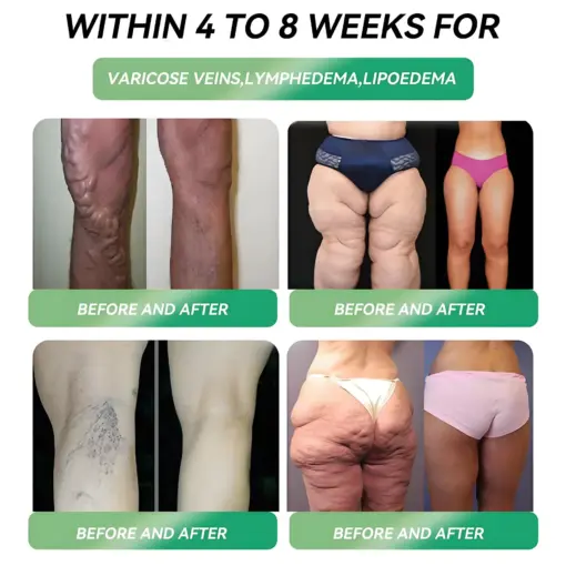 𝑳𝒆𝒓𝒄𝒆𝒂® GLP-1 Oral Weight Loss Solution Indications