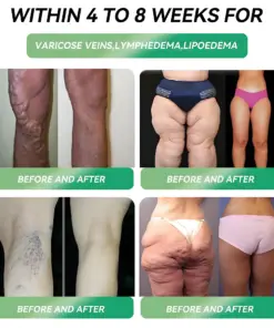 𝐋𝐞𝐫𝐜𝐞𝐚® GLP-1 Slimming Oral Solution