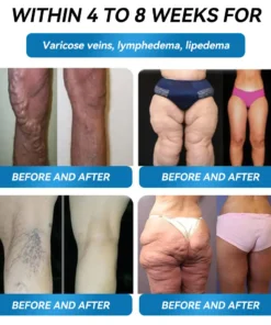 𝗟𝑬𝗥𝗖𝑬𝗔® 𝗚𝗟𝑃-𝟭 Super Concentrated Weight Loss Gum