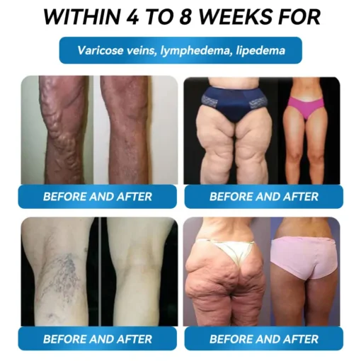 𝗟𝑬𝗥𝗖𝑬𝗔® 𝗚𝗟𝑃-𝟭 Super Concentrated Weight Loss Gum